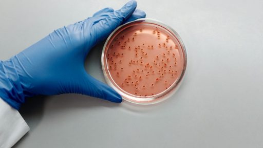 Bacterial MurJ Protein