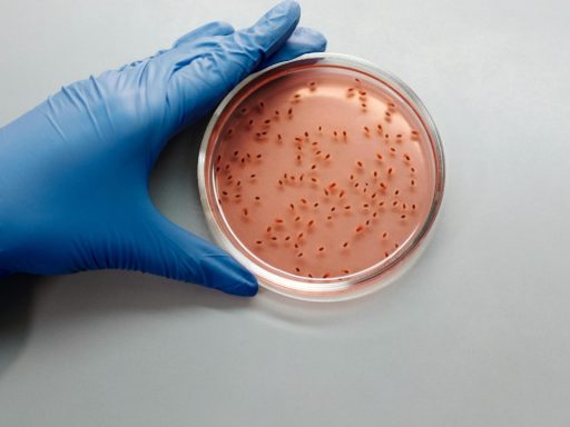 Bacterial MurJ Protein