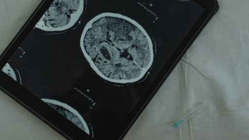 Sleep Brain