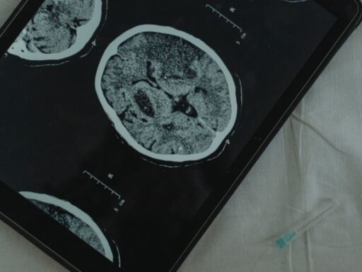 Sleep Brain