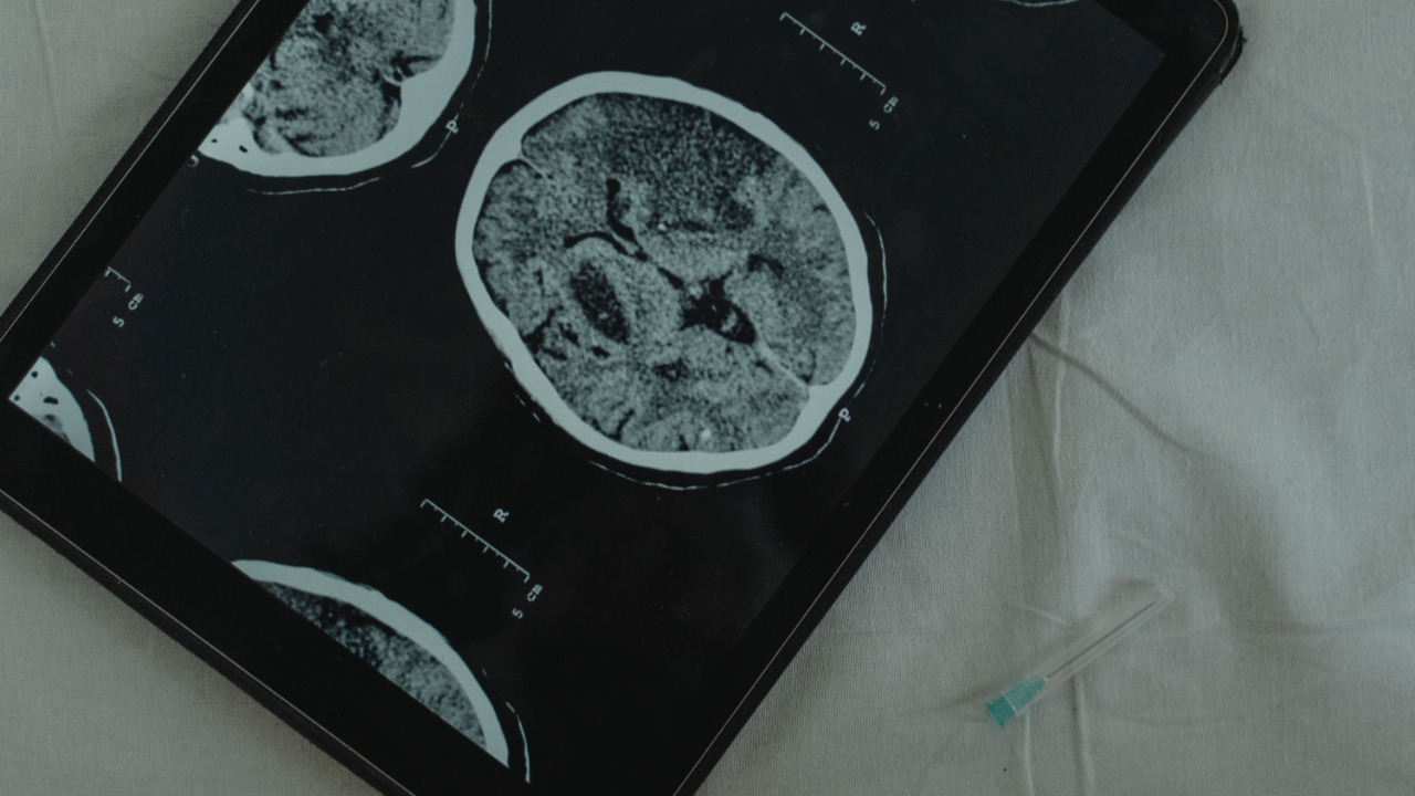 Sleep Brain