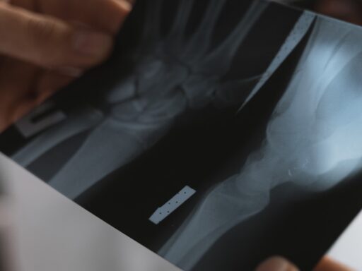 X-Rays