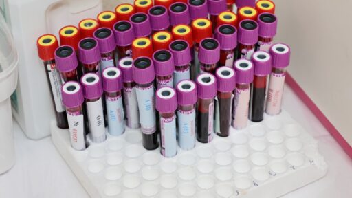 blood test