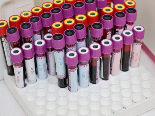blood test
