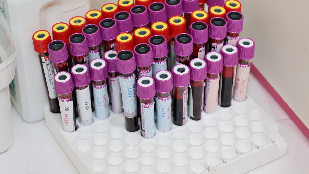 blood test