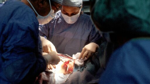 Colon Cancer