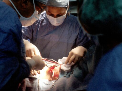 Colon Cancer