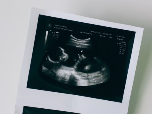 human embryo
