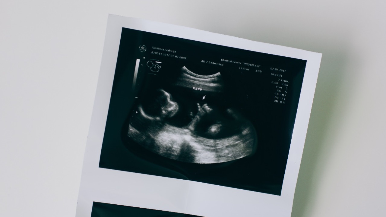 human embryo