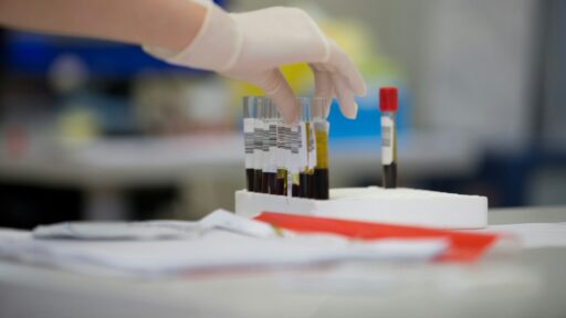 AI Blood Test
