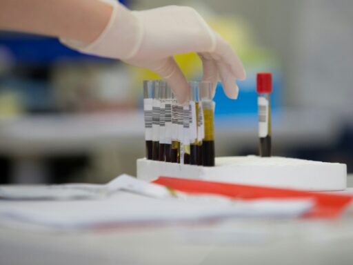 AI Blood Test