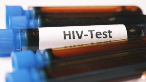HIV