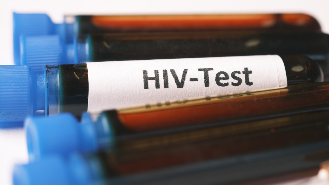 HIV