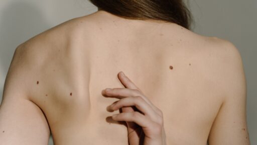 Mole