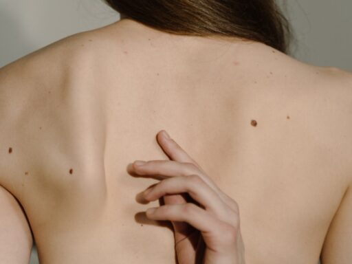 Mole