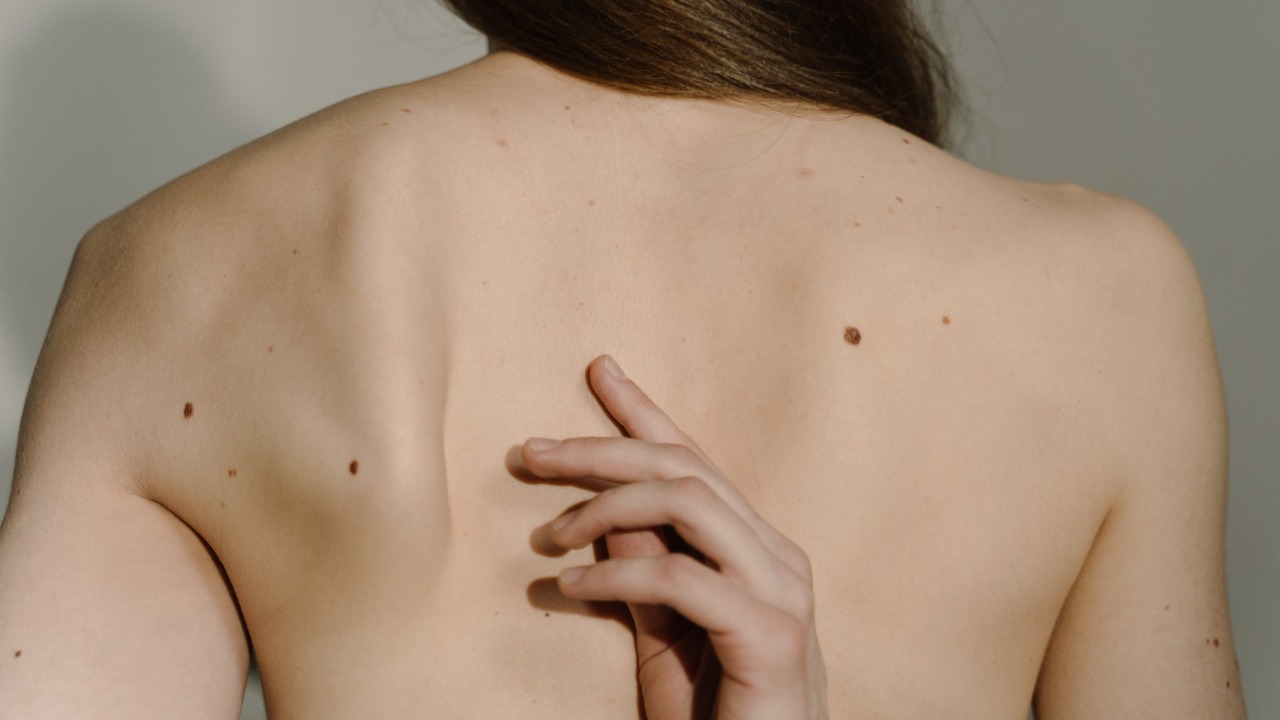 Mole